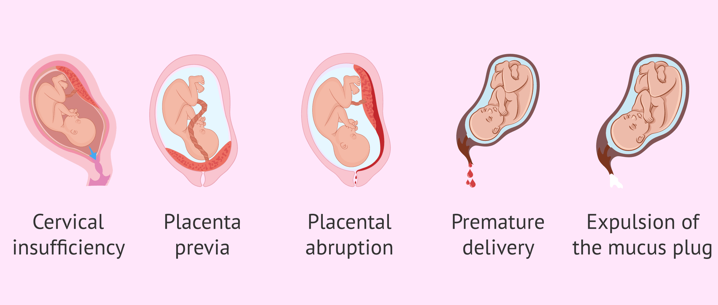Dream Meaning of Bleeding While Pregnant