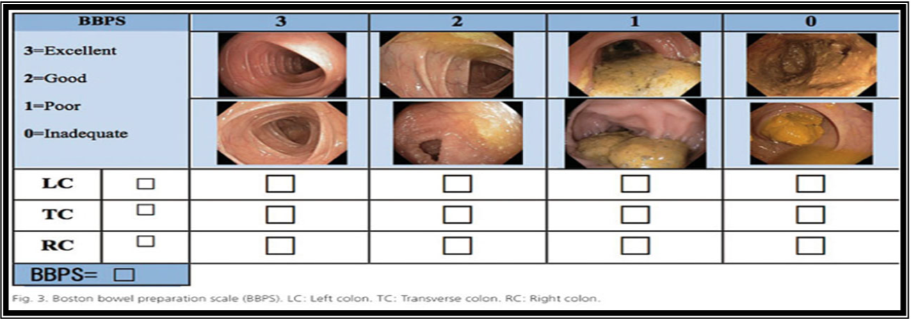 Boston Scale Bowel Preparation: What It Measures and Why It Matters