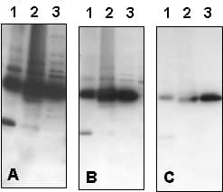 Western Blot Figures and Legends: A Guide to Proper Documentation