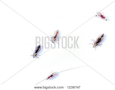 Dream Meaning of Big Head Lice