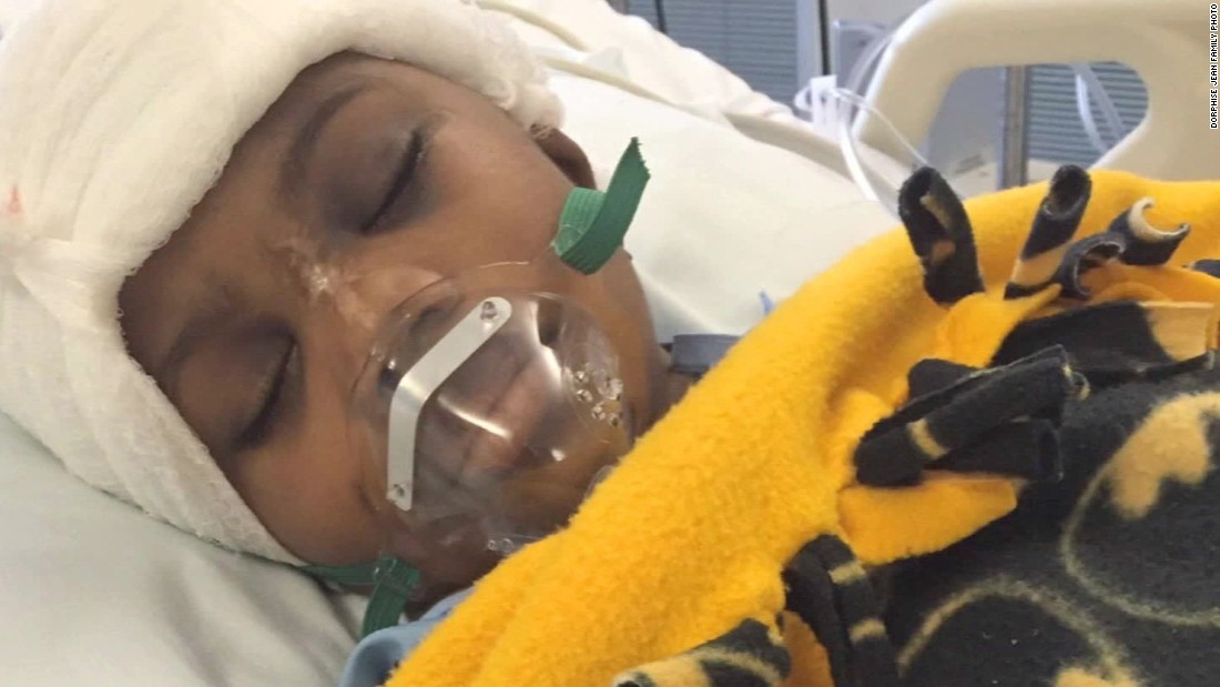 Dream Meaning of Being Shot In The Head