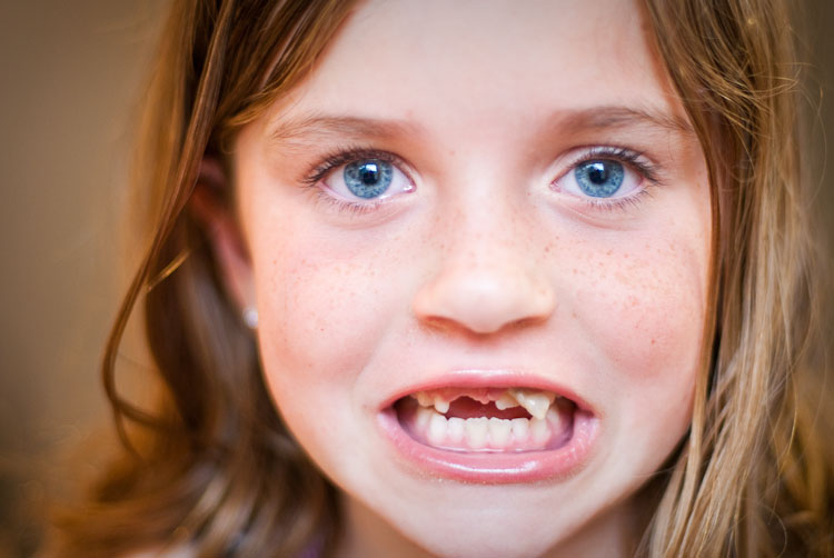 Dream Meaning of A Loose Tooth