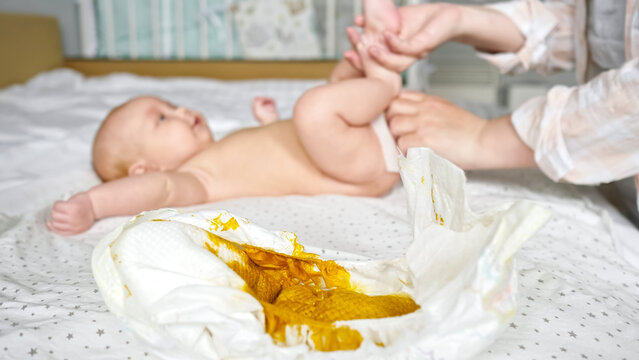 Dream Meaning of Baby Dirty Diaper