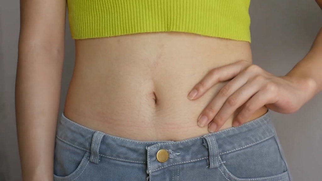 Dream Meaning of Belly Button