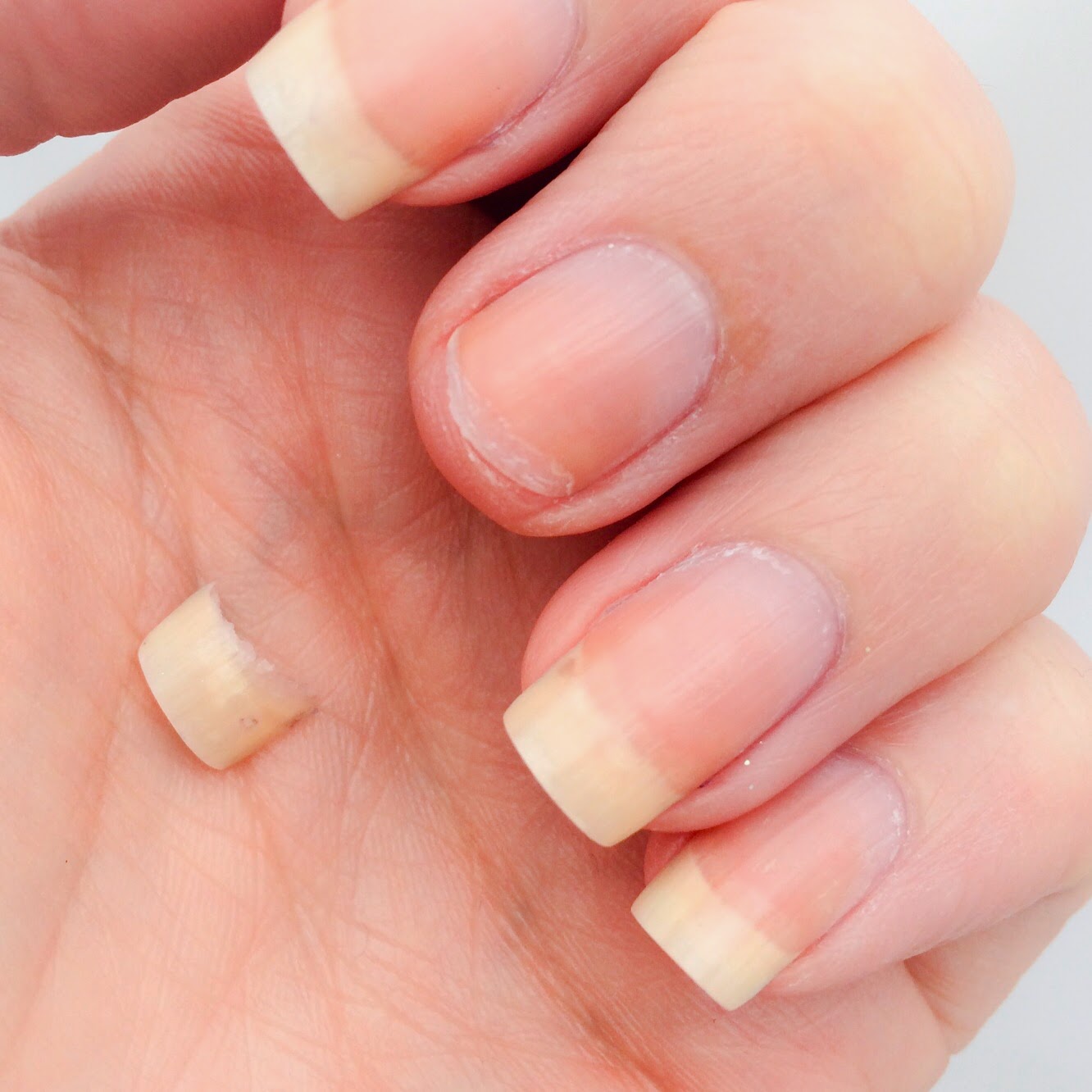 Dream Meaning of Broken Nail