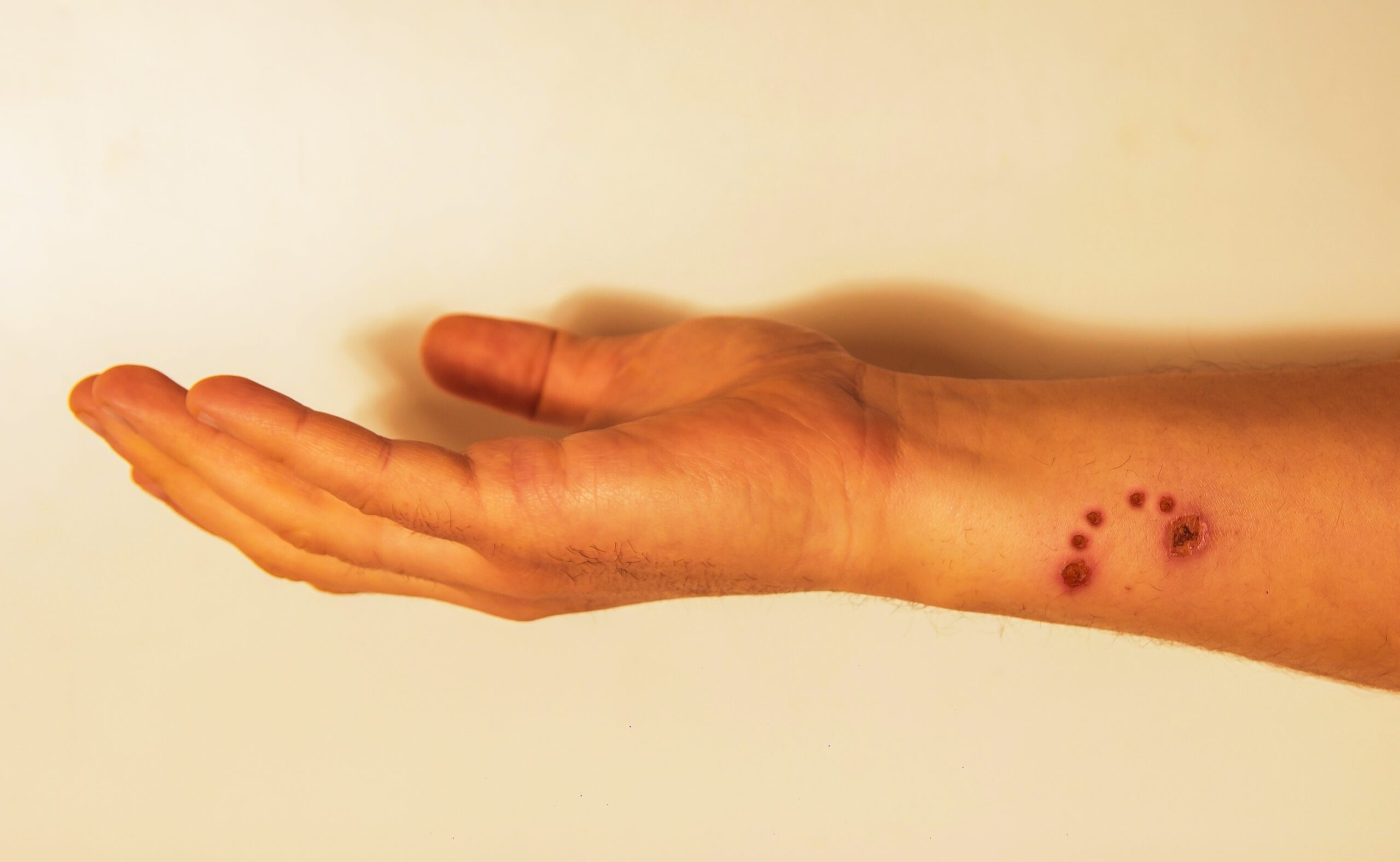 Dream Meaning of Dog Bite On Hand