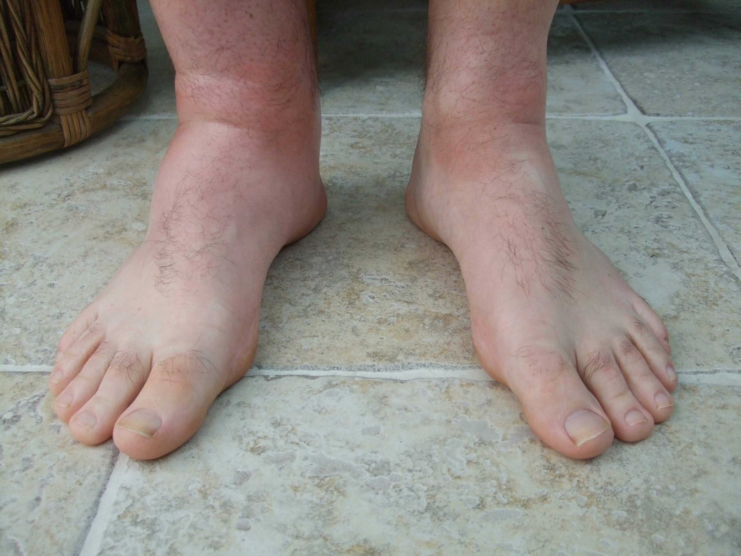 Dream Meaning of Bees Stinging Left Foot