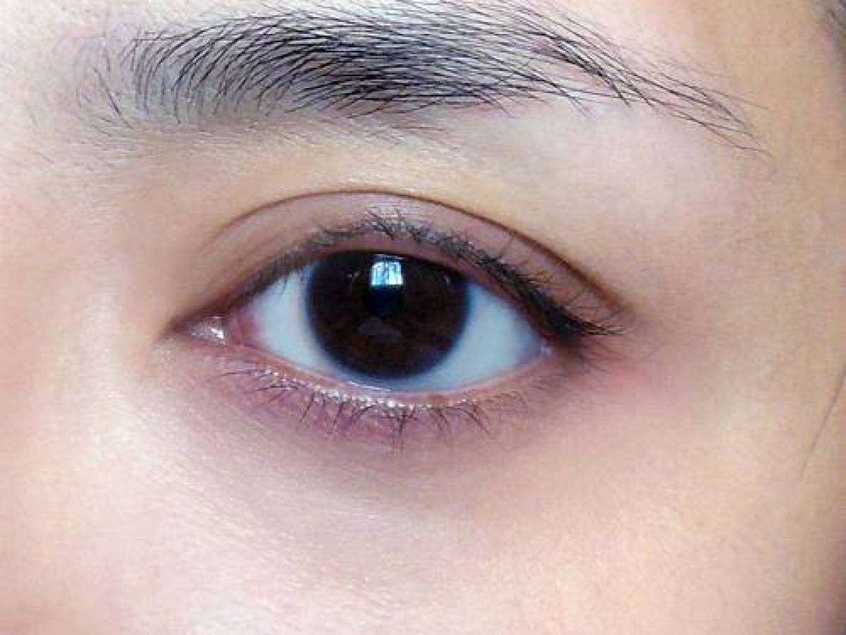 Dream Meaning of Black Eyes