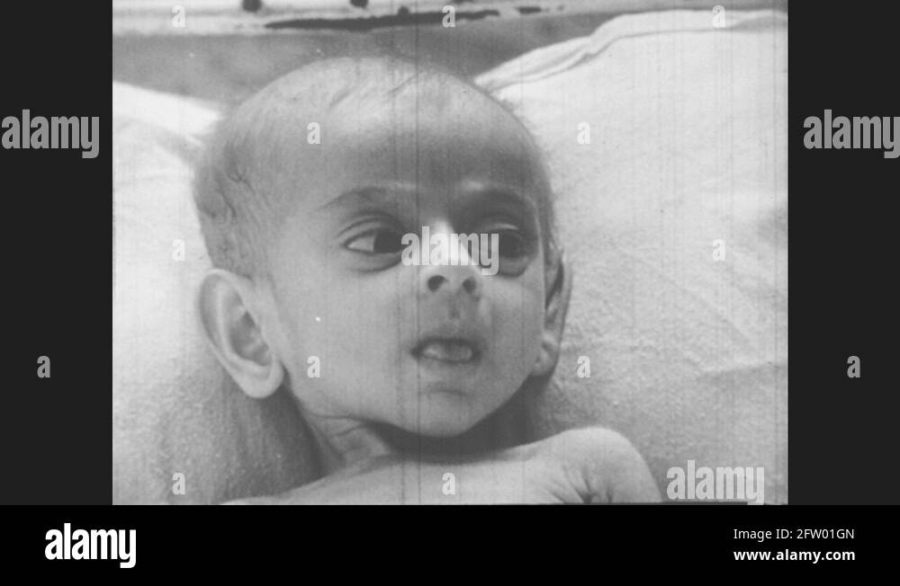 Dream Meaning of A Malnourished Baby