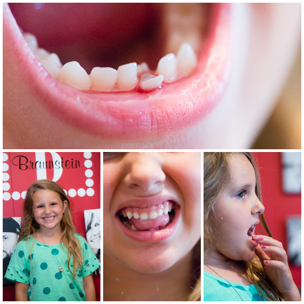 Dream Meaning of A Tooth Falling Out