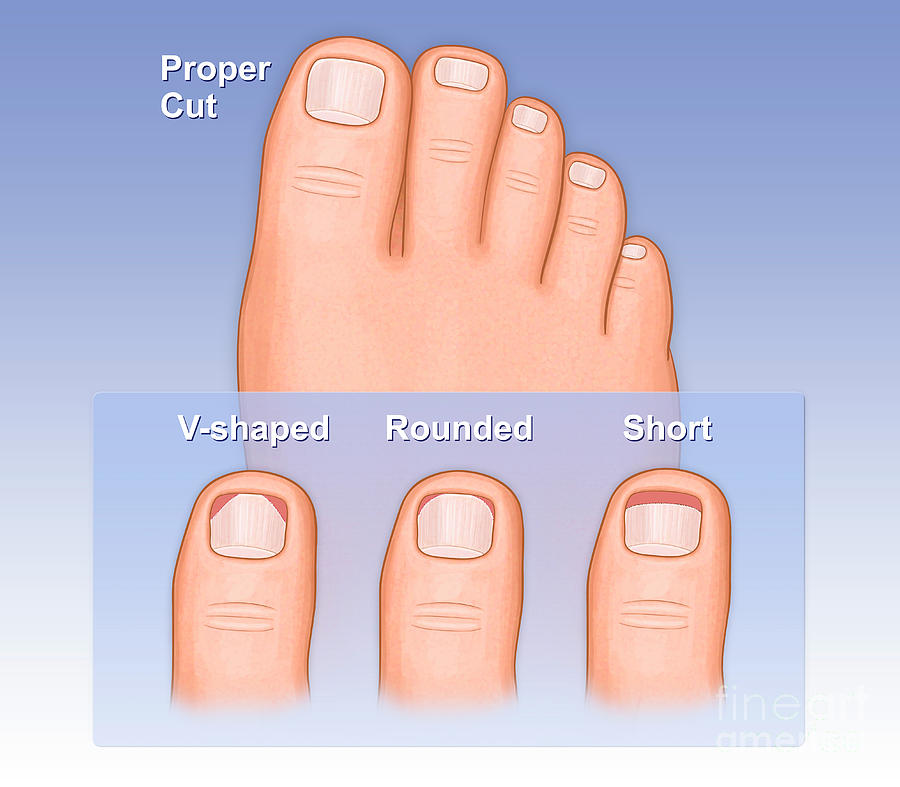 Dream Meaning of Cutting Your Toenails