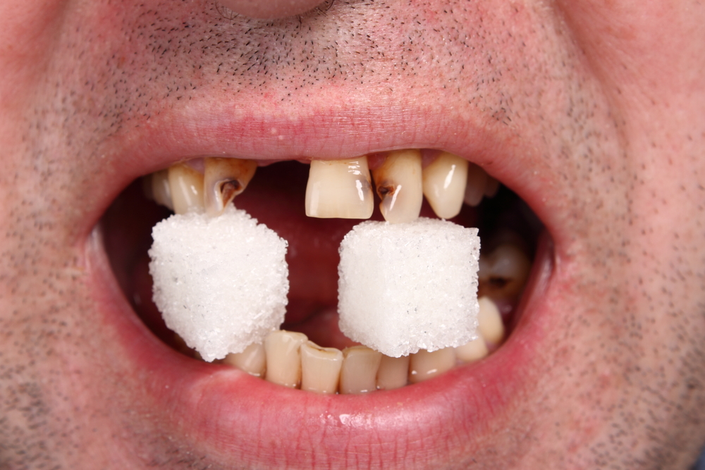 Dream Meaning of Breaking Teeth