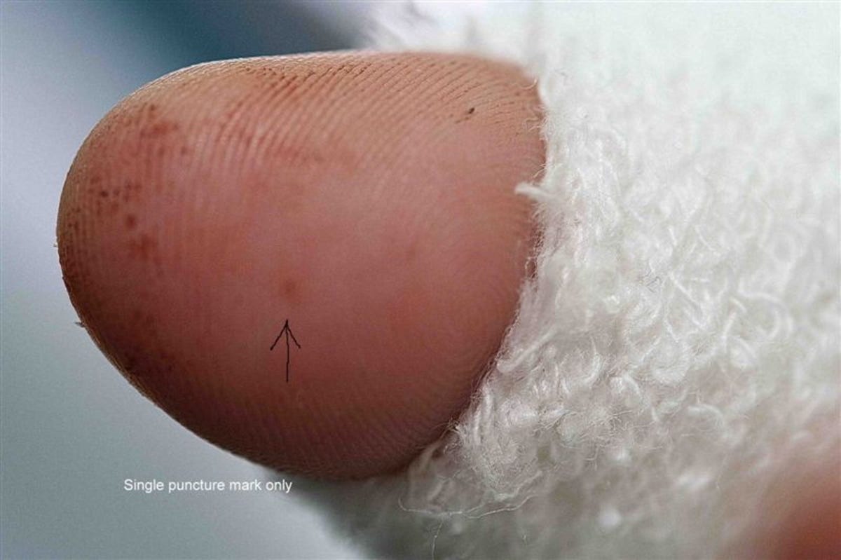 Dream Meaning of Black Snake Bite