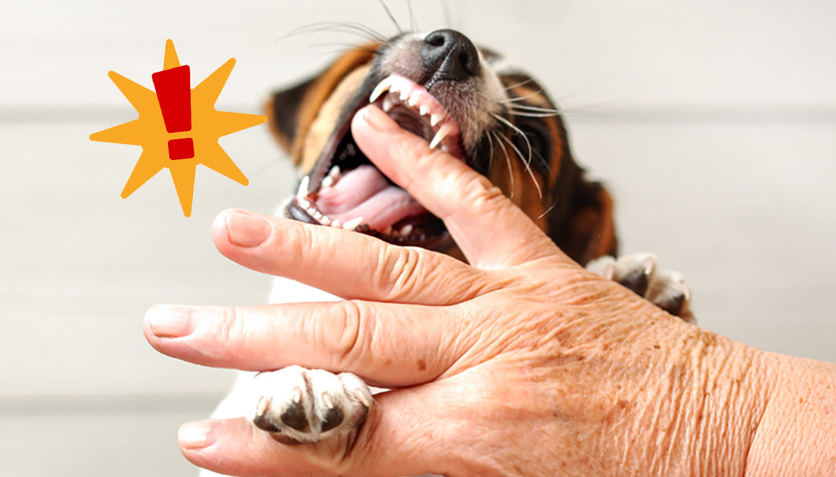 Dream Meaning of Dog Biting My Hand